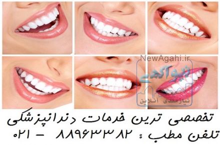معروف ترین دندانپزشک تهران بهترین دندانپزشک تهران