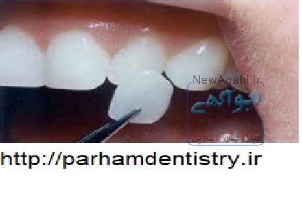 ارائه خدمات دندان پزشکی نوین