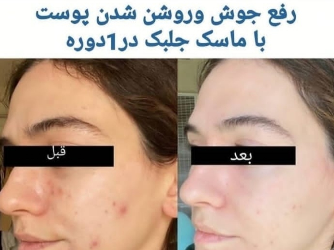 ماسک جلبک دریایی