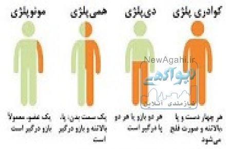 كلينيك کاردرمانی وگفتاردرماني حسن پور